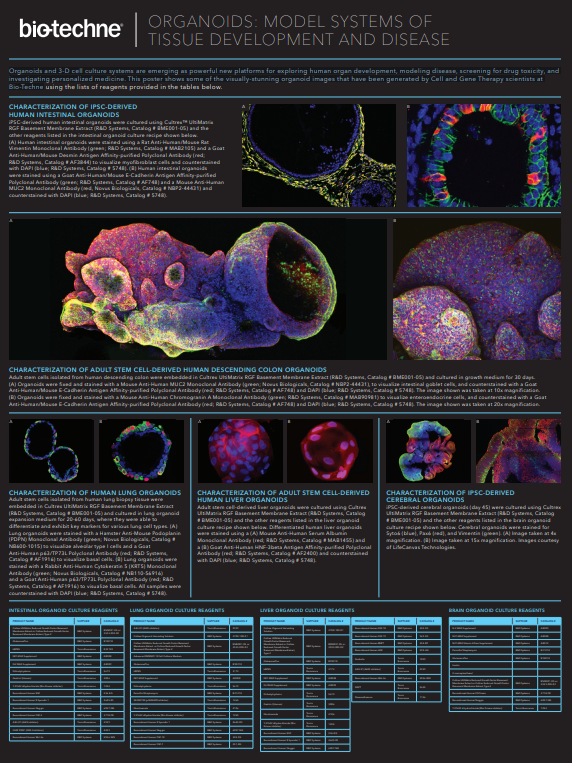 Organoids: Model Systems of Tissue Development and Disease