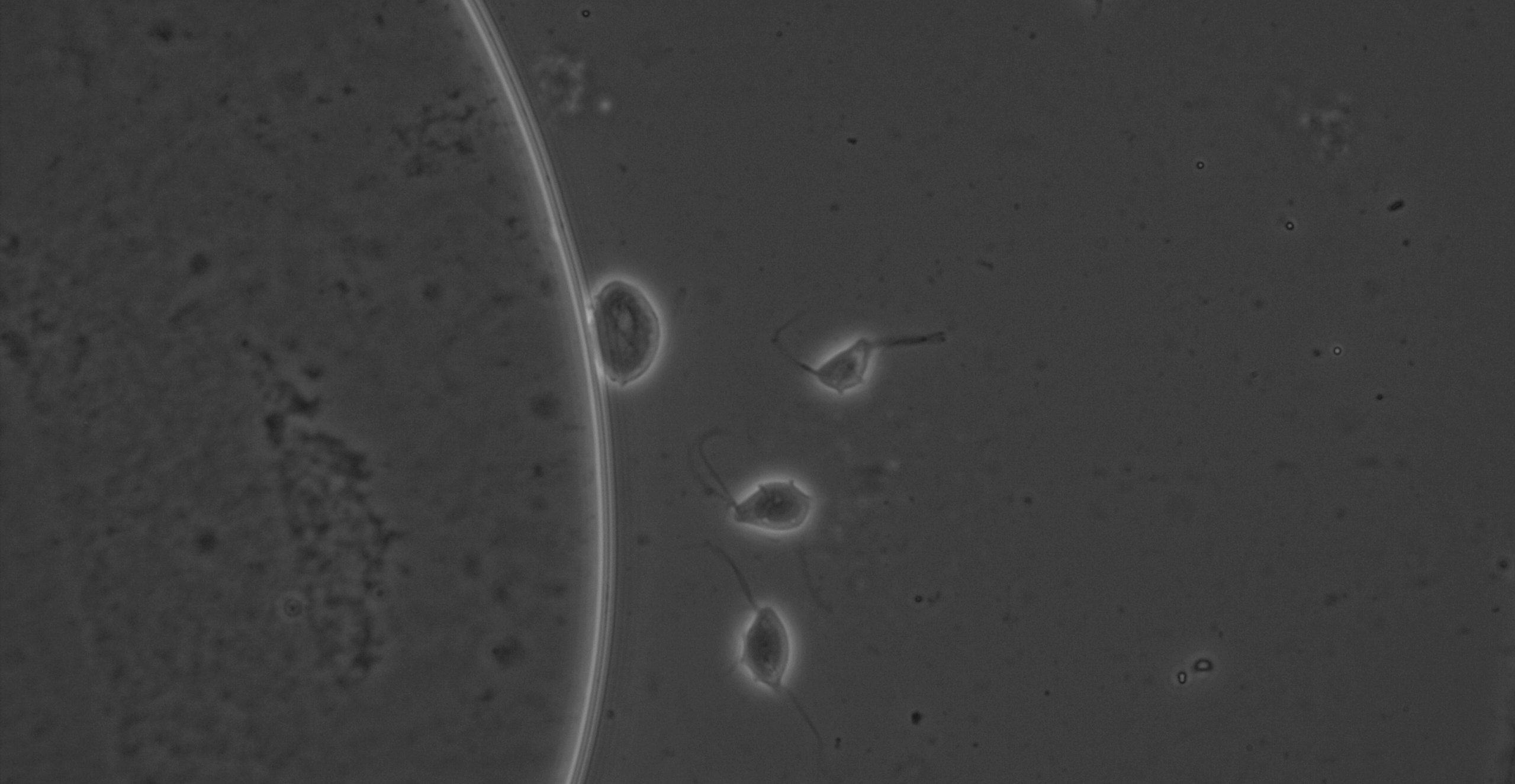 Microscopic Examination of Living Specimens of the Parasite Trichomonas ...