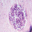transzmissziós toxoplazmózis