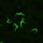 Pdf Genome Wide Snp Analysis Reveals Distinct Origins Of Trypanosoma Evansi And Trypanosoma Equiperdum