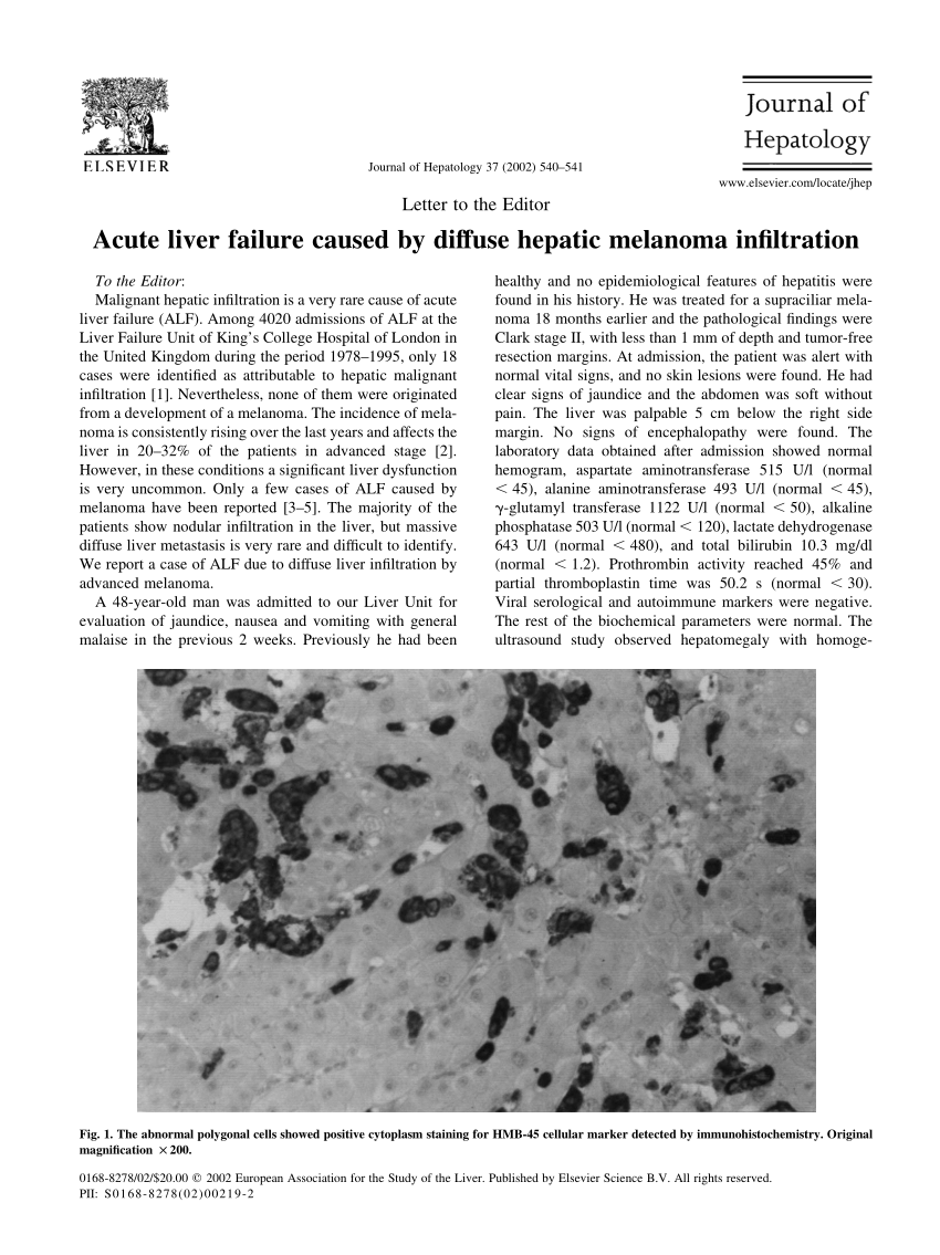 pdf-acute-liver-failure-caused-by-hepatic-melanoma-infiltration