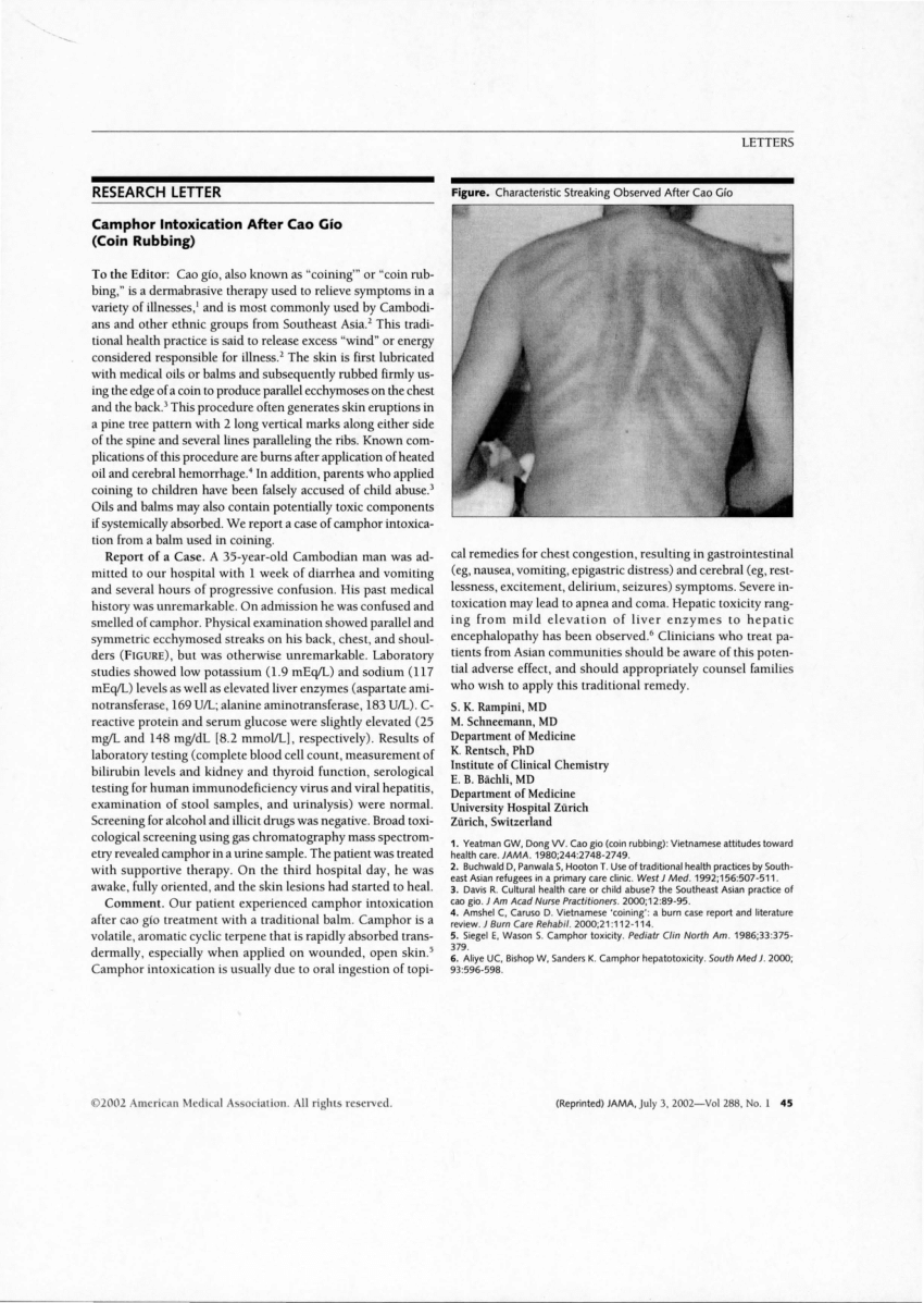 PDF Camphor intoxication after Cao G o Coin rubbing 3