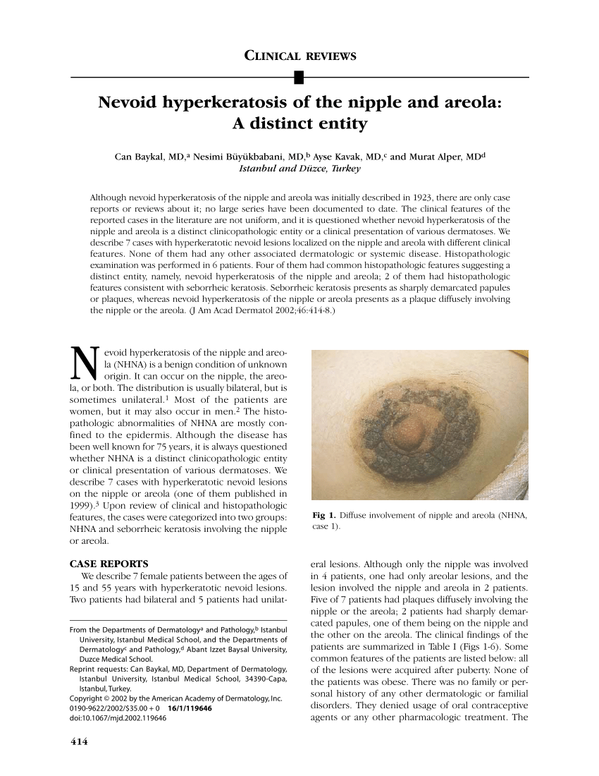 Hyperkeratosis of the nipple and areola
