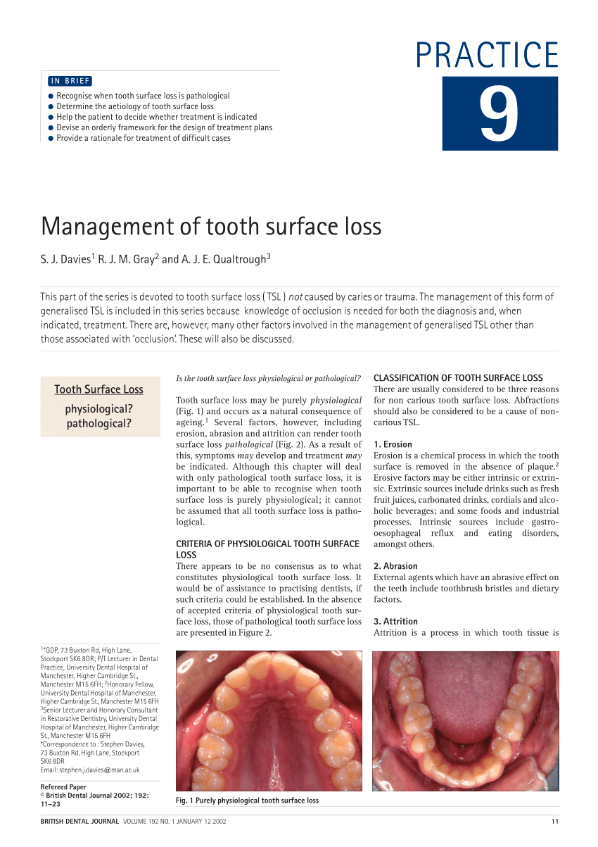 Treatment planning for the heavily compromised tooth by Stephen Franks