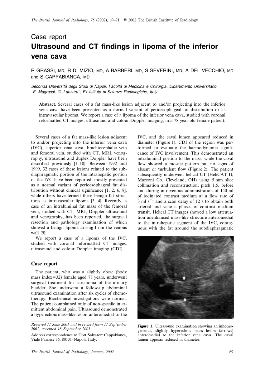 case study of lipoma patient