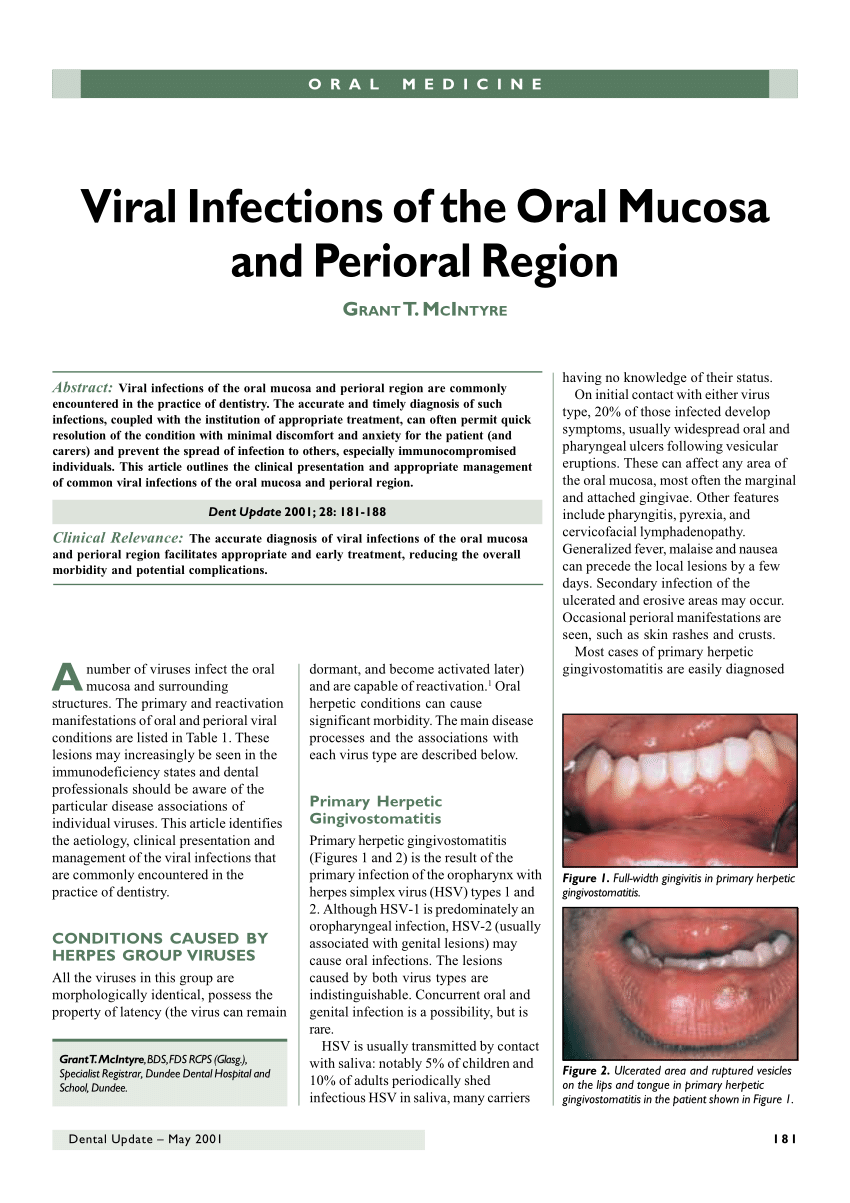 (PDF) Viral Infections of the Oral Mucosa and Perioral Region