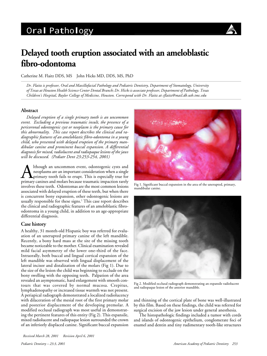 Pdf Delayed Tooth Eruption Associated With An Ameloblastic Fibro Odontoma