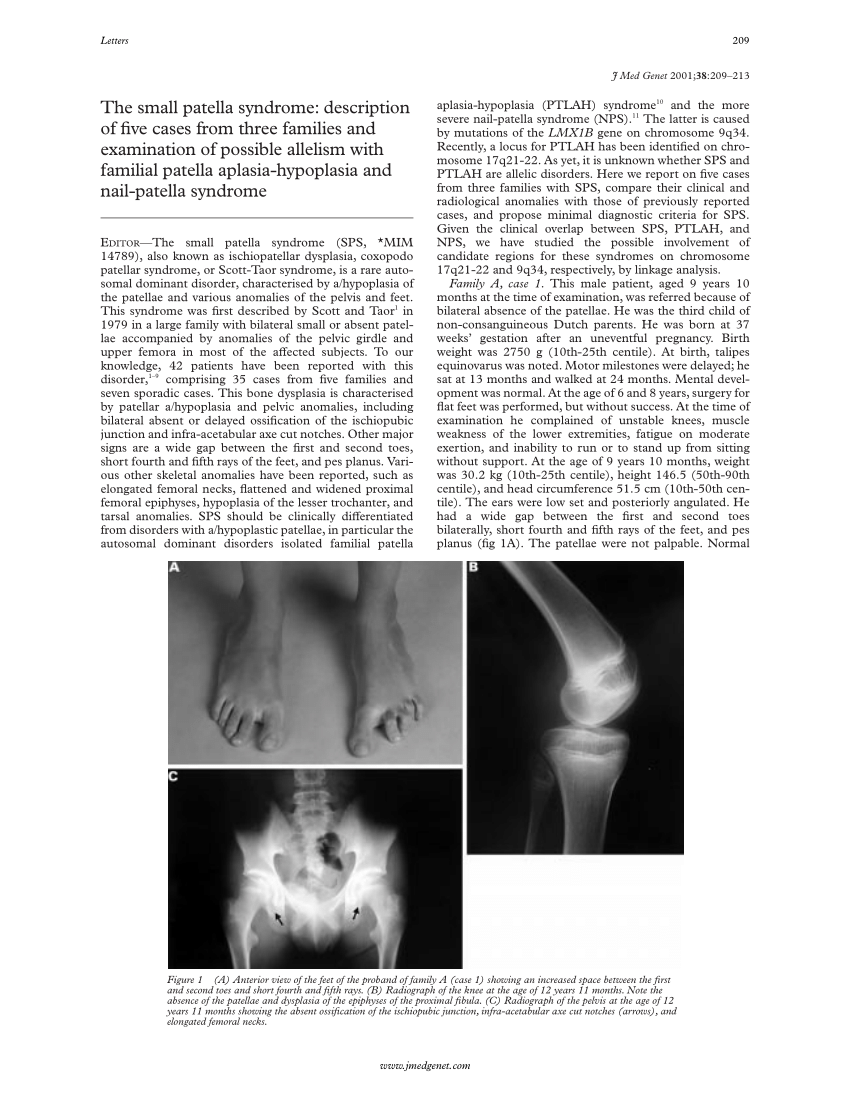 Radiographic findings in the nail-patella syndrome. - Abstract - Europe PMC