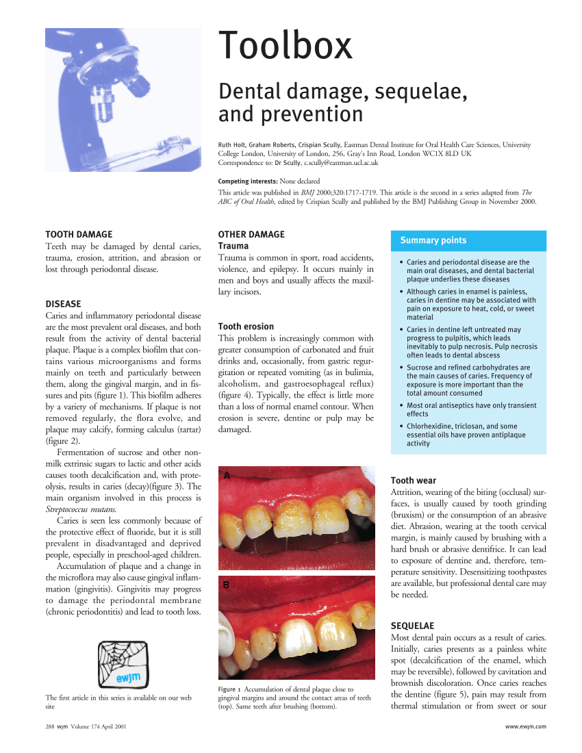 Pdf Dental Damage Sequelae And Prevention