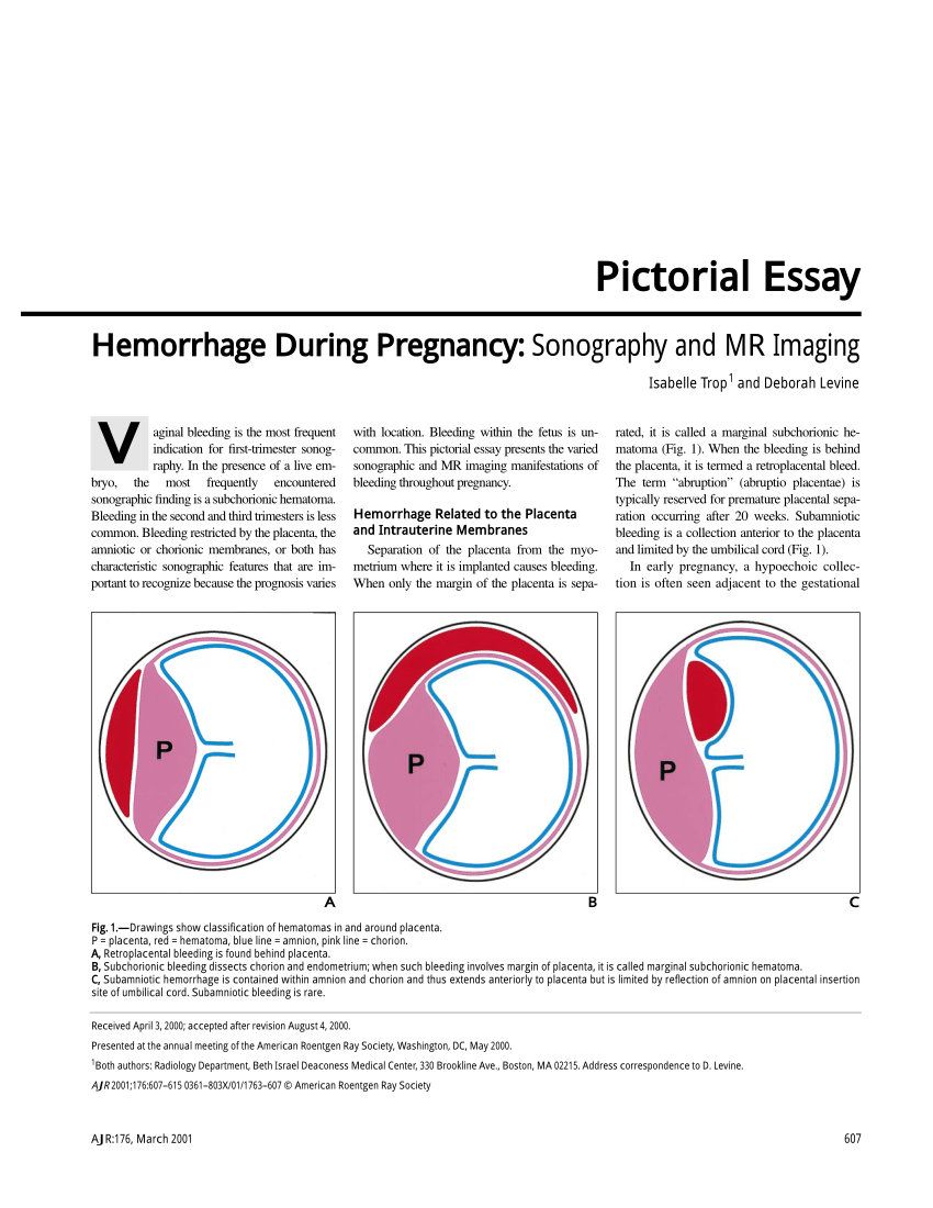 Pdf Hemorrhage During Pregnancy Sonography And Mr Imaging