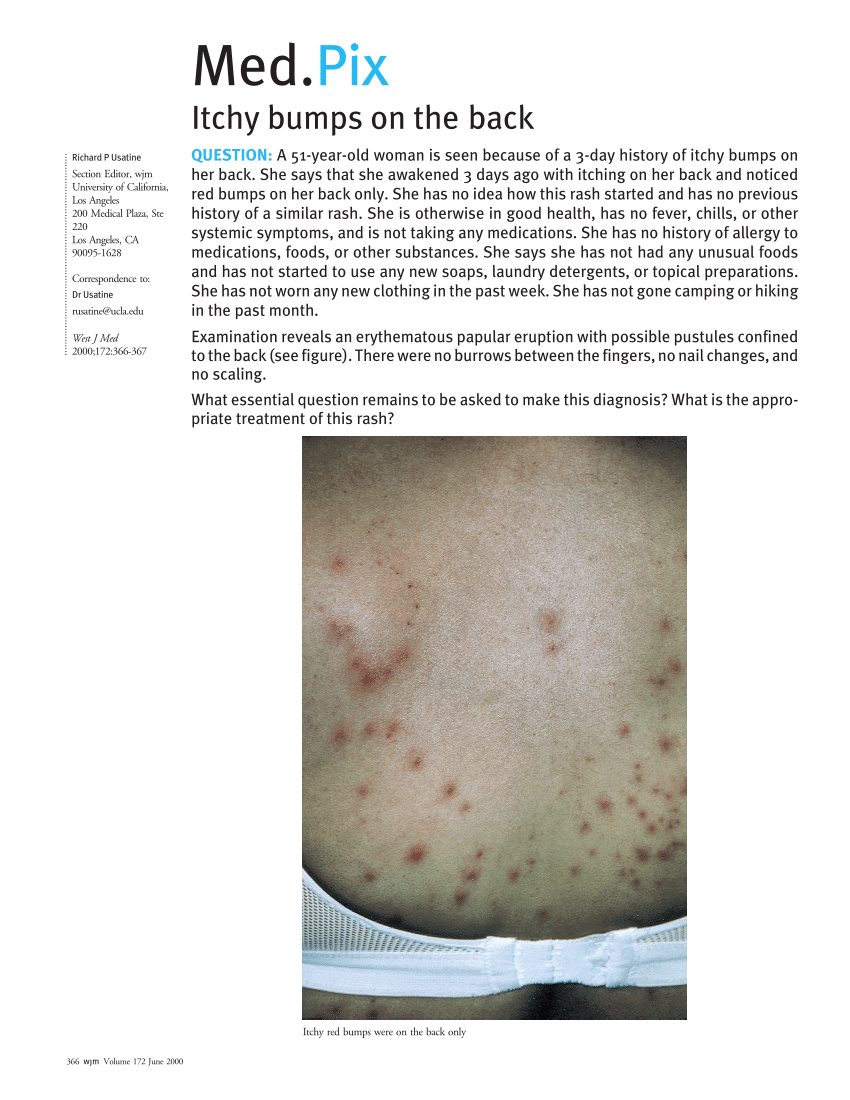 pdf-itchy-bumps-on-the-back