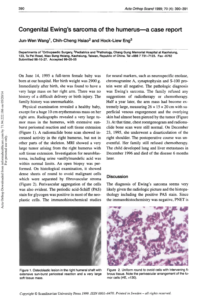 (PDF) Congenital Ewing's sarcoma of the humerus - A case report