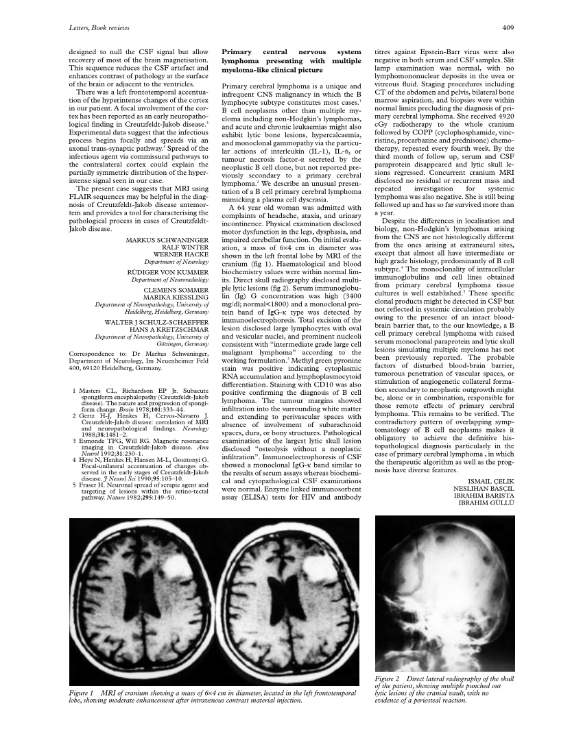 Pdf Primary Central Nervous System Lymphoma Presenting With Multiple Myeloma Like Clinical Picture 