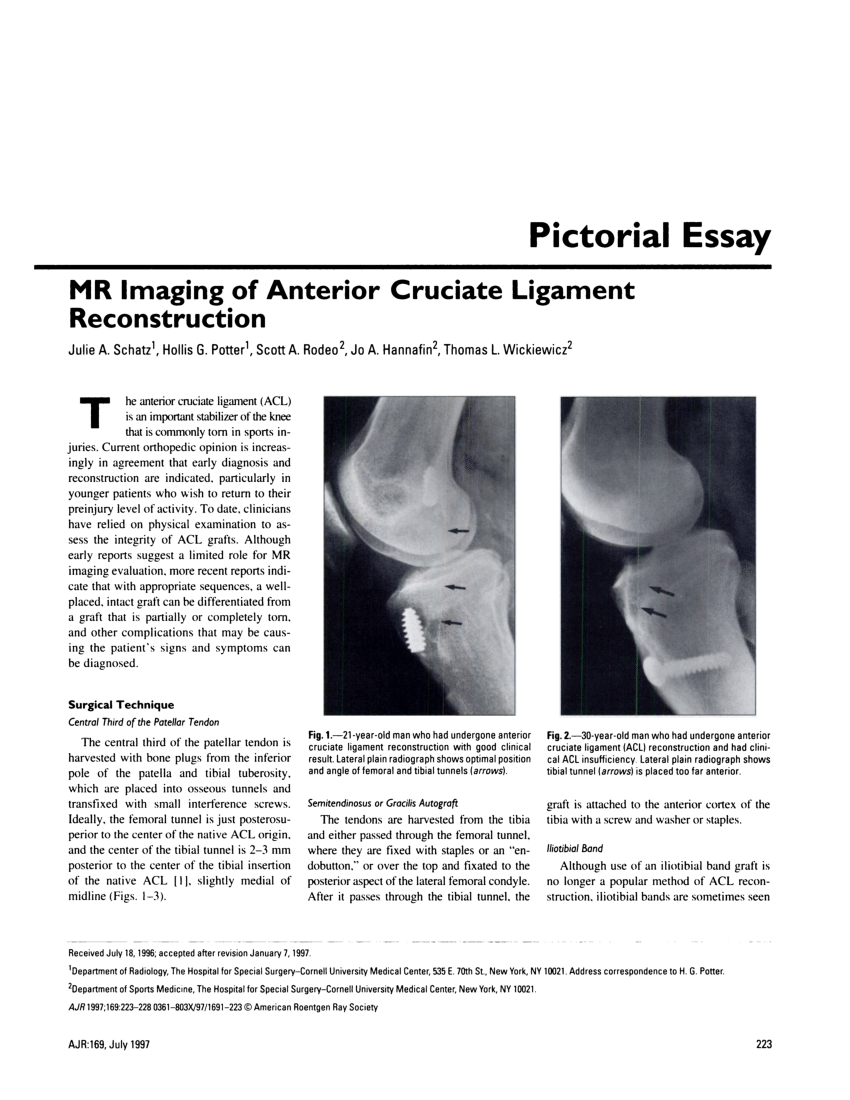 Pdf Mr Imaging Of Anterior Cruciate Ligament Reconstruction 5632