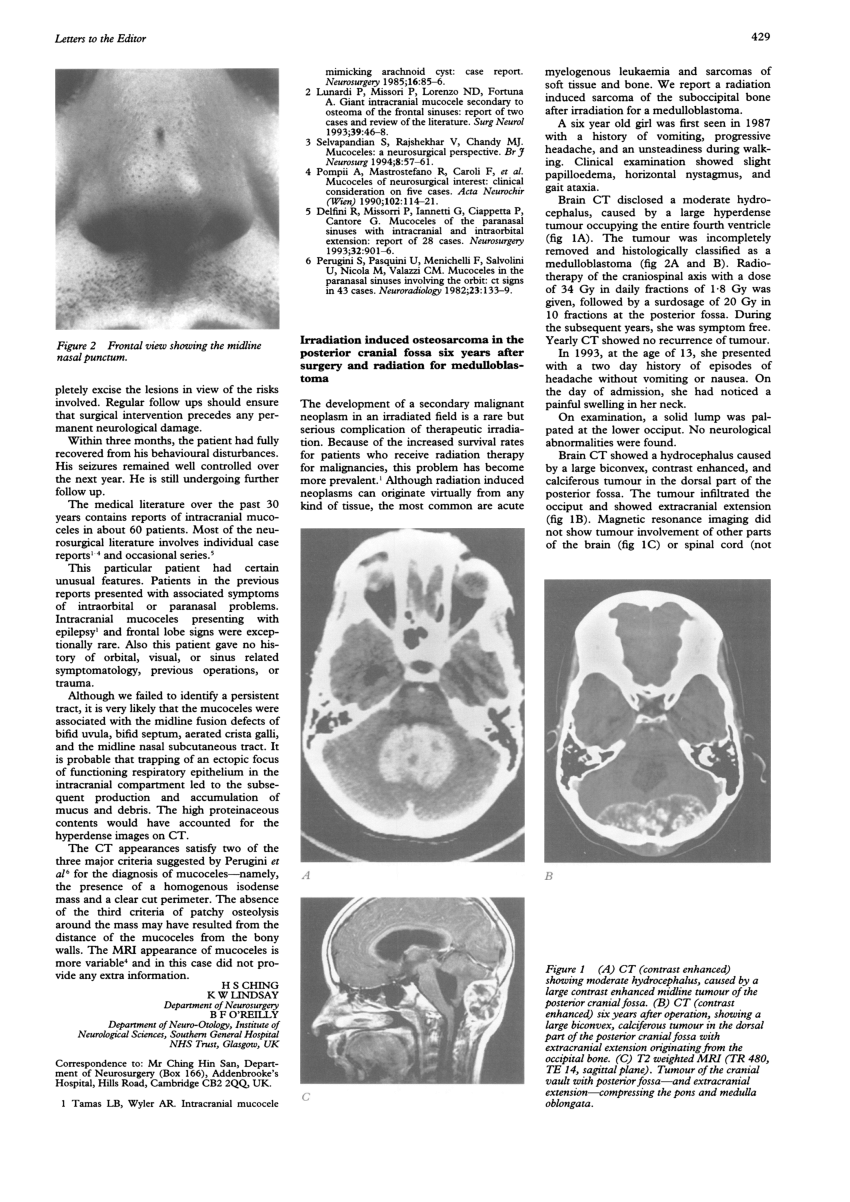 Pdf Irradiation Induced Osteosarcoma In The Posterior Cranial Fossa Six Years After Surgery 0469