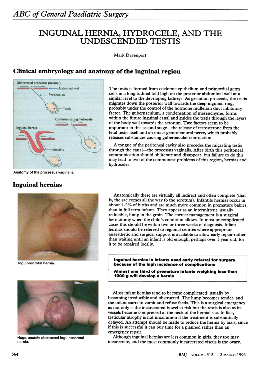 RACGP - Inguinal hernias in children