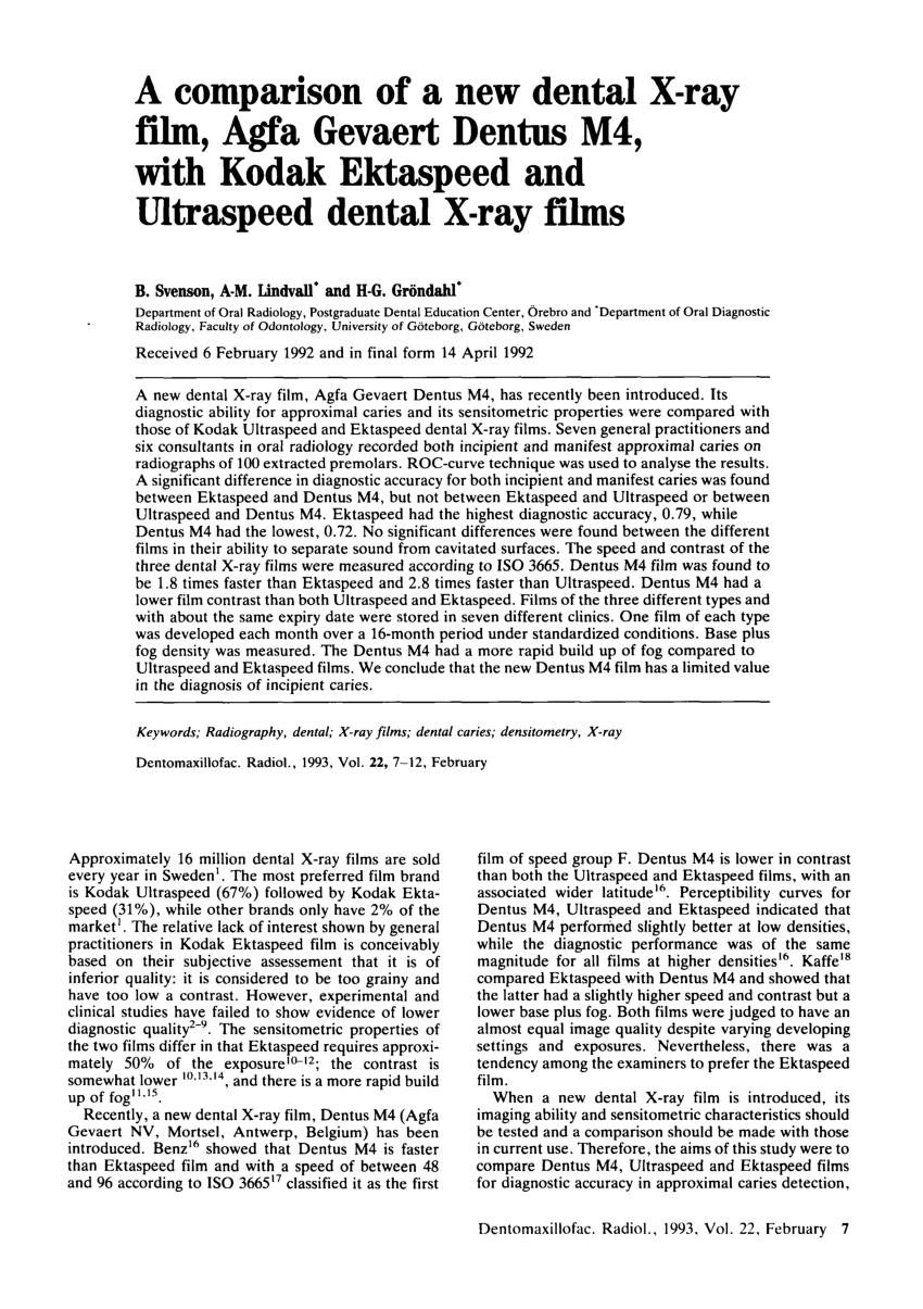 Film Viewers / Densitometers - Film Viewing Aids - NDT Film Image