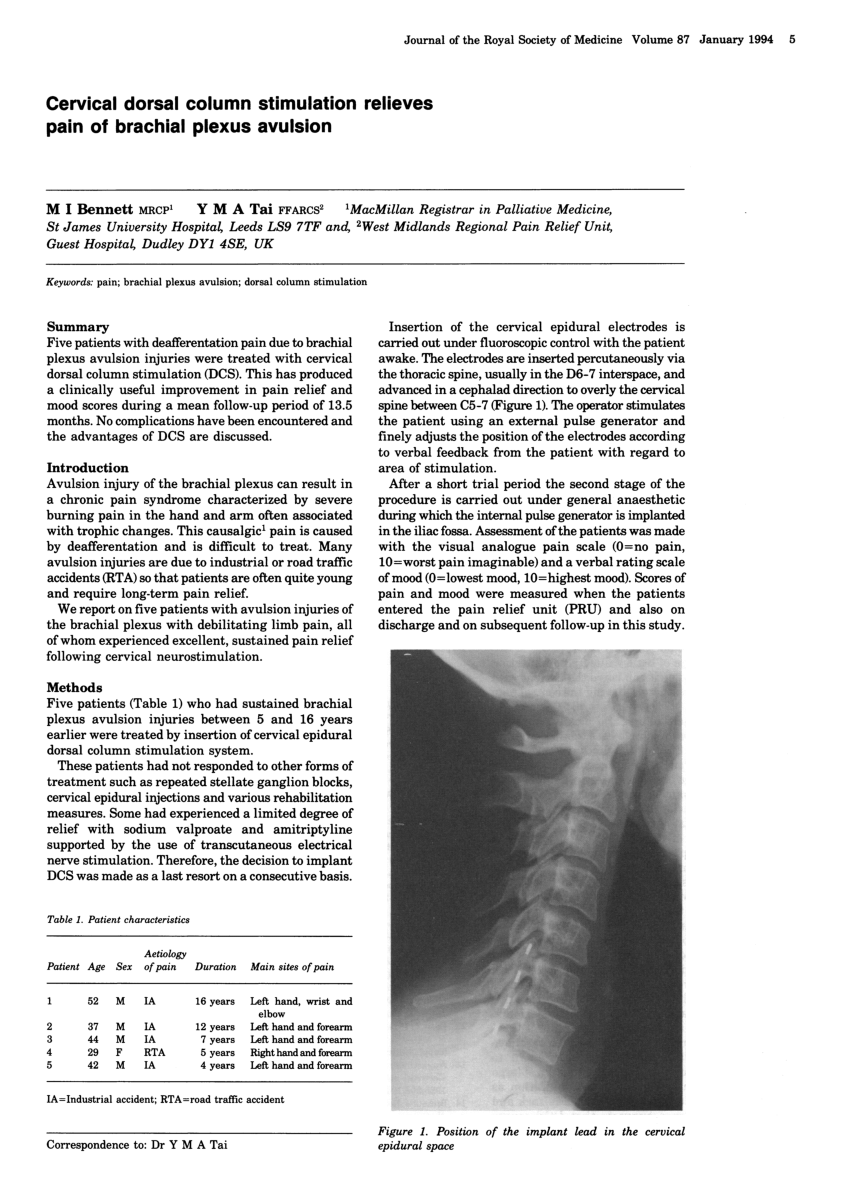 dorsal column stimulator trial