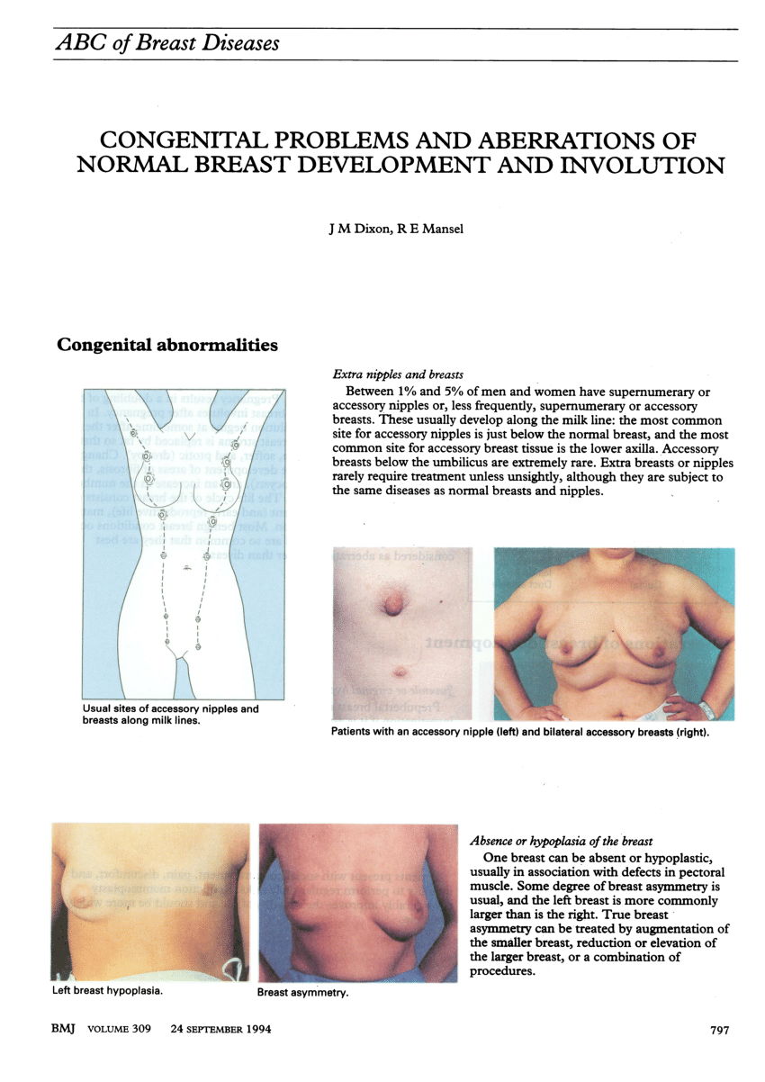 Nipple Problems & Disorders in Women