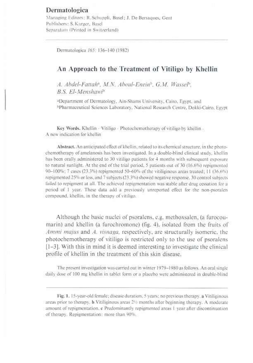 research paper on vitiligo