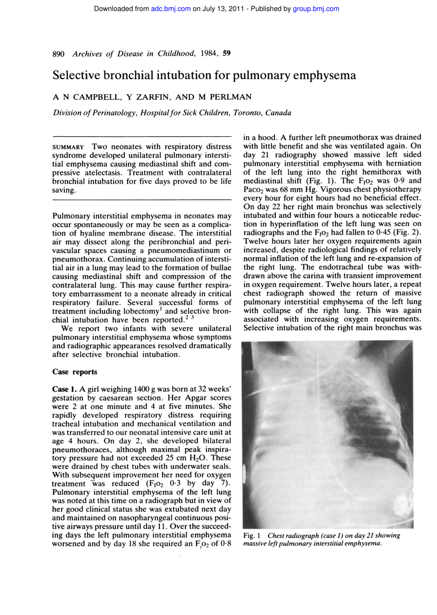 emphysema case study pdf