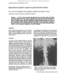 Preview image for Spontaneous splenic rupture in polyarteritis nodosa