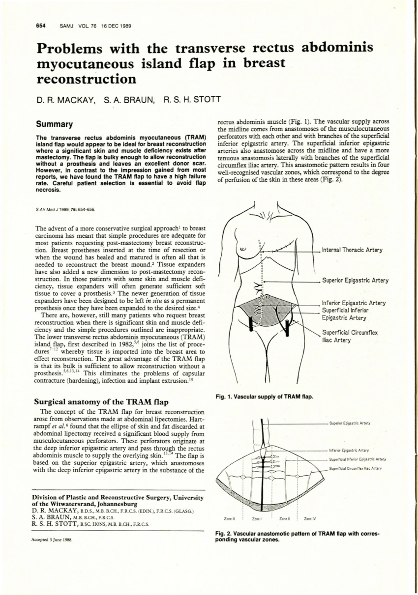 RBCP - Breast reconstruction with implant: creating a pocket with a reverse  serratus anterior muscle flap