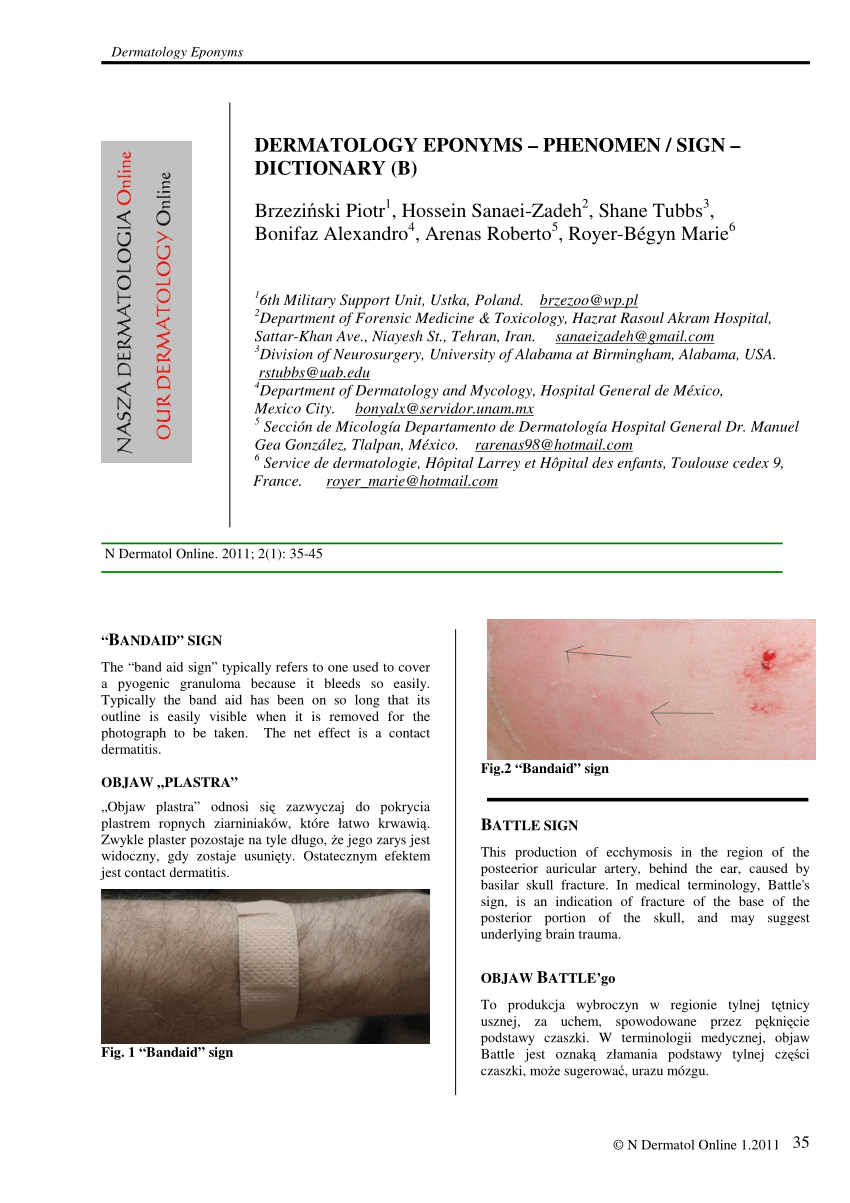 PDF Pityriasis rosea in 12 months old infant