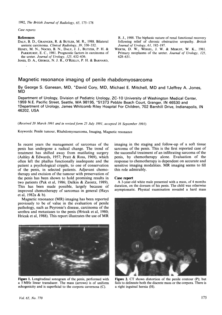 Pdf Magnetic Resonance Imaging Of Penile Rhabdomyosarcoma 5735