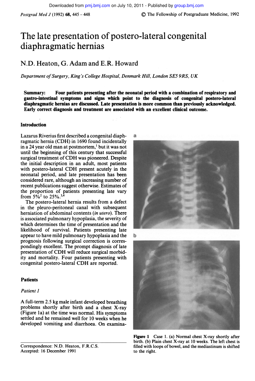 Pdf The Late Presentation Of Postero Lateral Congenital Diaphragmatic