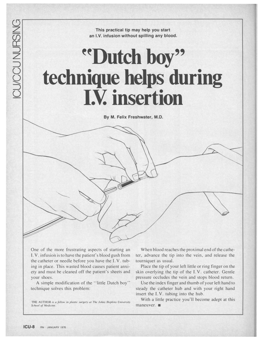 pdf-dutch-boy-technique-helps-during-i-v-insertion