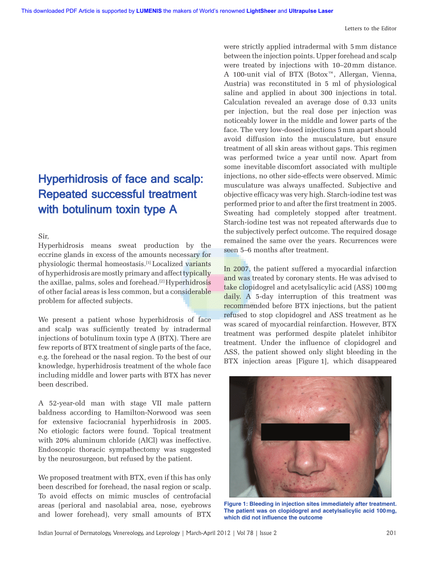 Pdf Hyperhidrosis Of Face And Scalp Repeated Successful Treatment