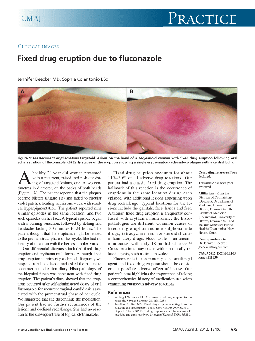allergic reaction to diflucan