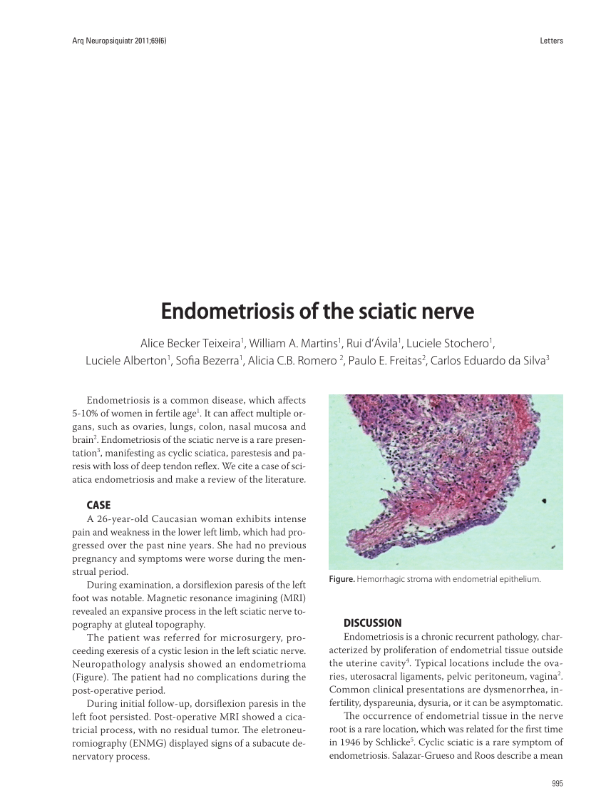 Pdf Endometriosis Of The Sciatic Nerve 