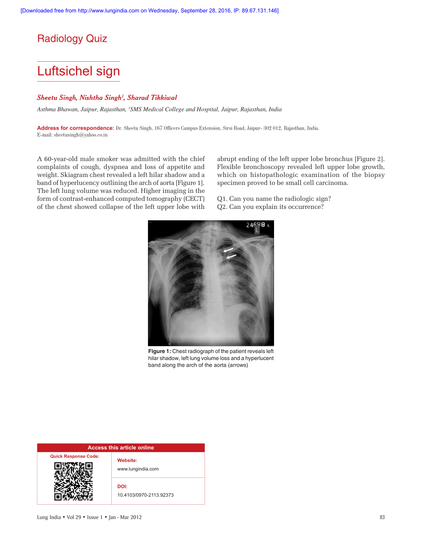 Reviewing chest X-ray images | The Radiologist posted on the topic |  LinkedIn