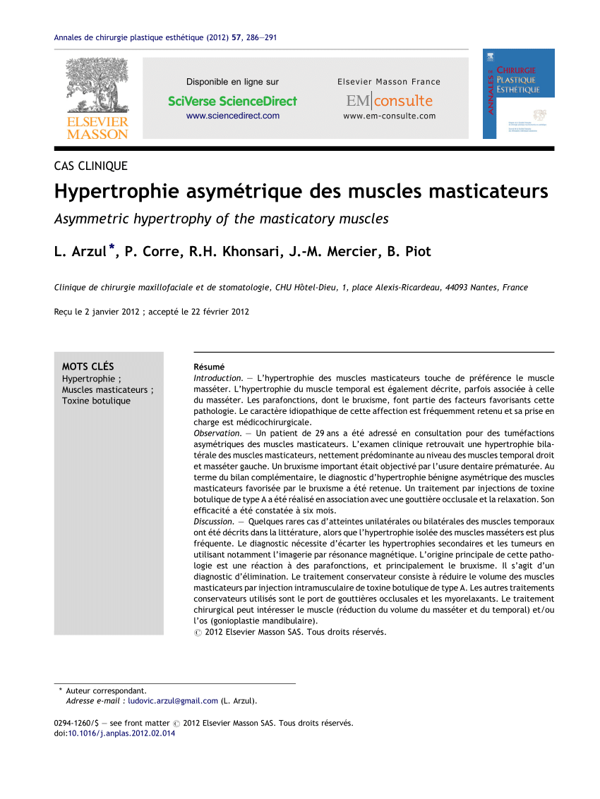 Hypertrophie asymétrique des muscles masticateurs - ScienceDirect
