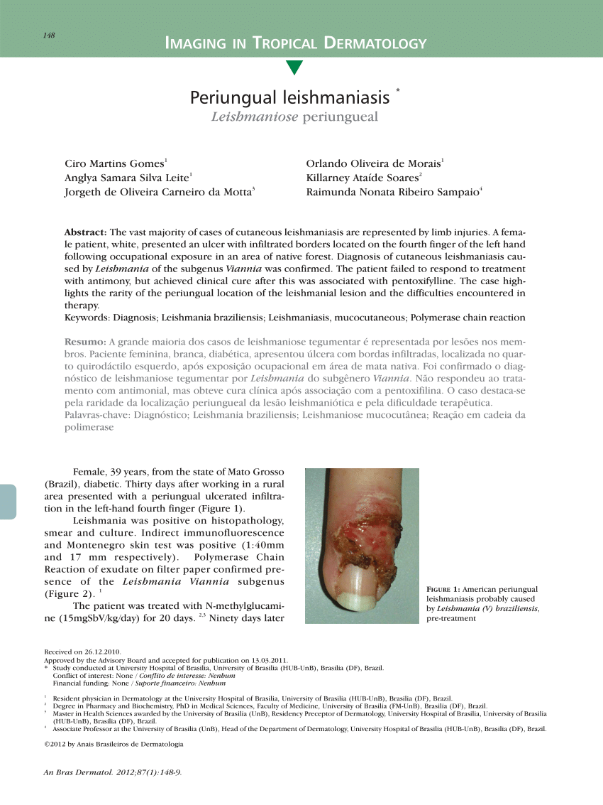 PDF Periungual leishmaniasis