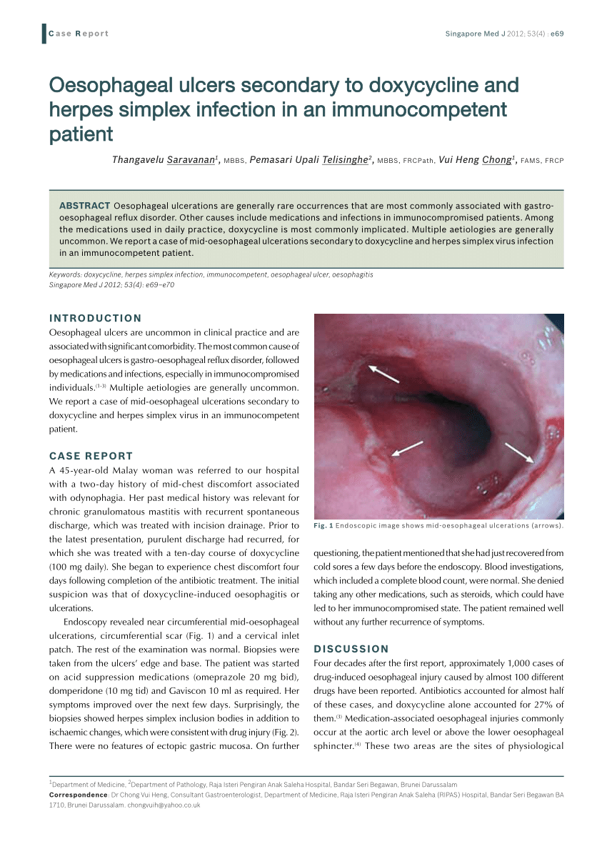 Pdf Oesophageal Ulcers Secondary To Doxycycline And Herpes Simplex