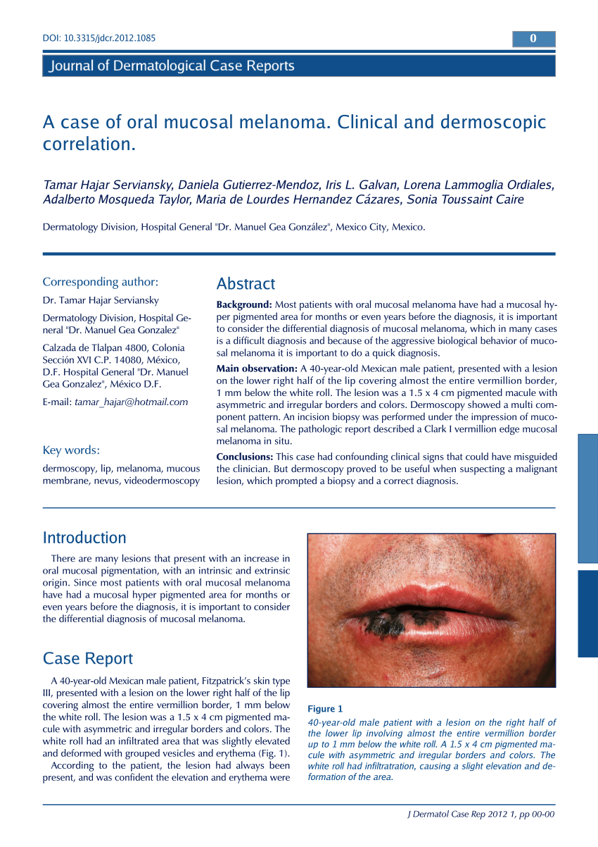 Pdf A Case Of Oral Mucosal Melanoma Clinical And Dermoscopic Correlation