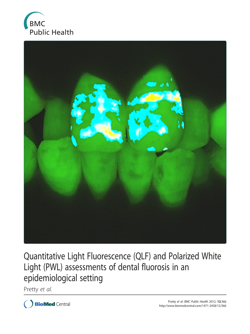 Pdf Quantitative Light Fluorescence Qlf And Polarized White Light Pwl Assessments Of 3721