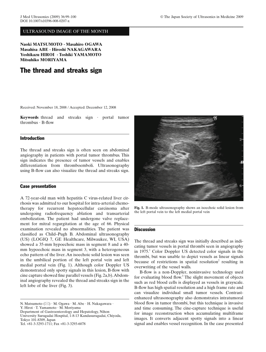 (PDF) The thread and streaks sign