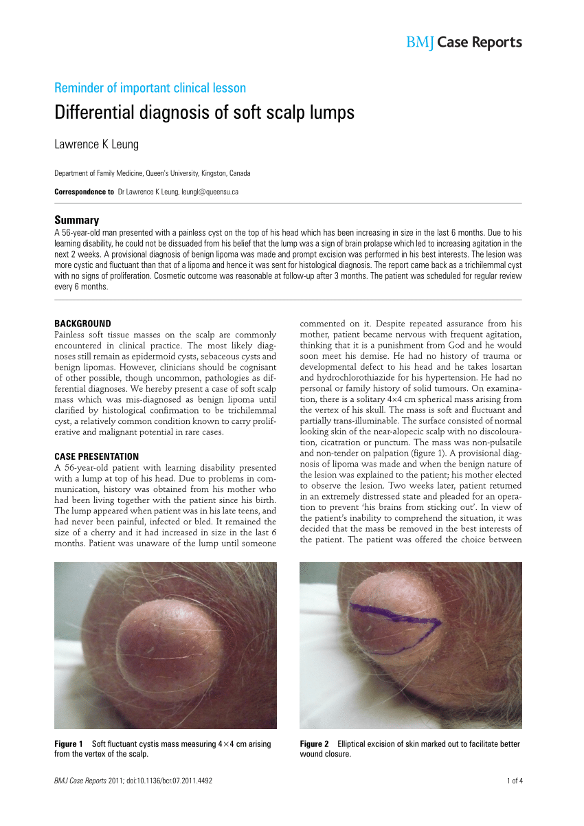Pdf Differential Diagnosis Of Soft Scalp Lumps