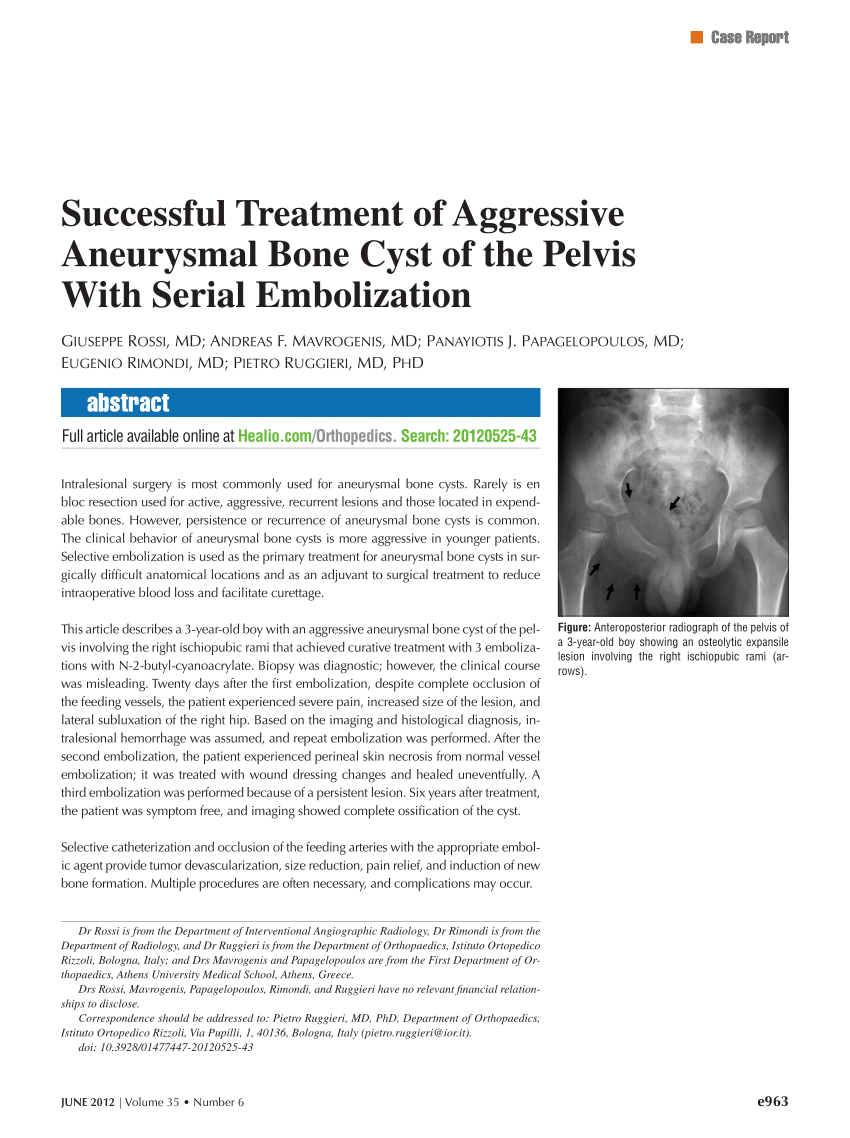 Pdf Successful Treatment Of Aggressive Aneurysmal Bone Cyst Of The Pelvis With Serial Embolization 9954