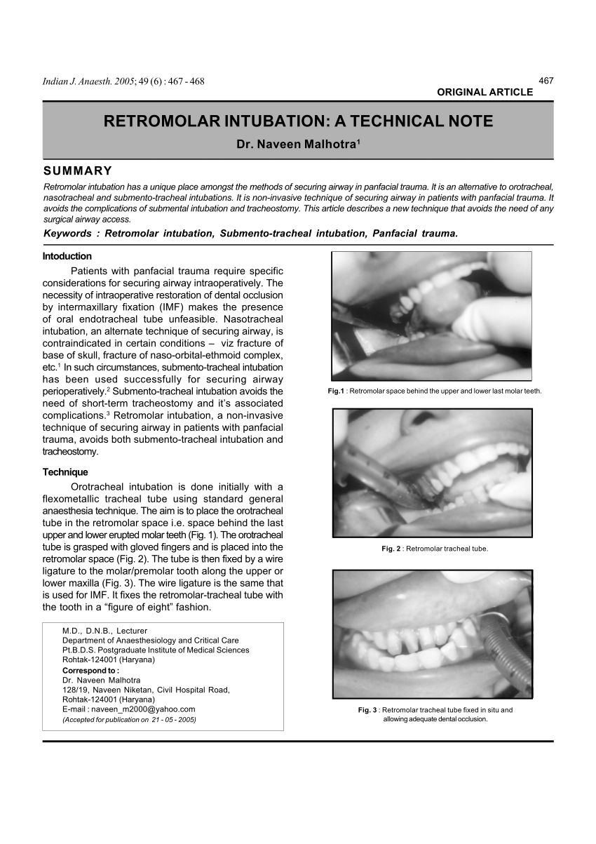 PDF Retromolar intubation A technical Note