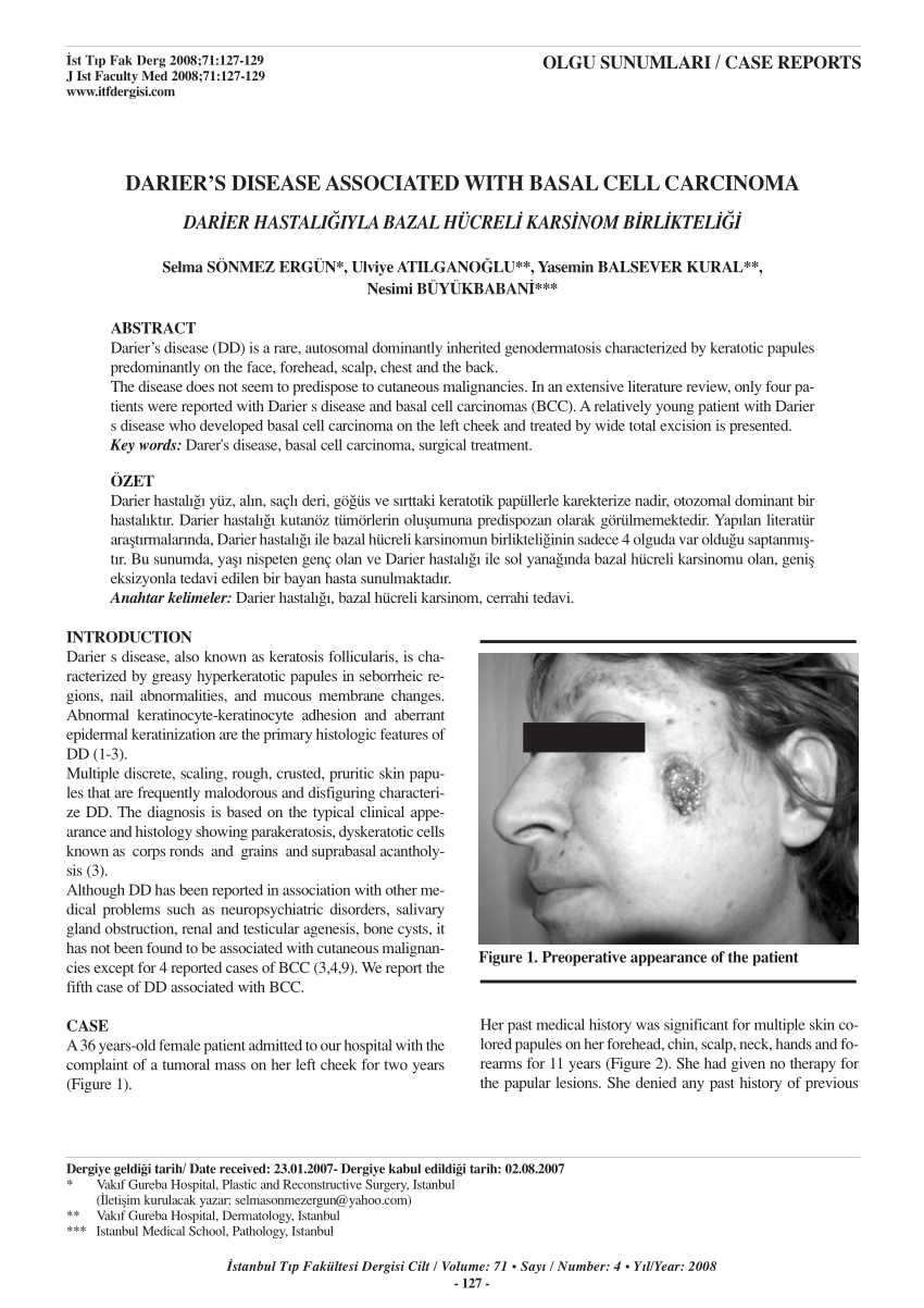 (PDF) Darier’s disease associated with basal cell carcinoma