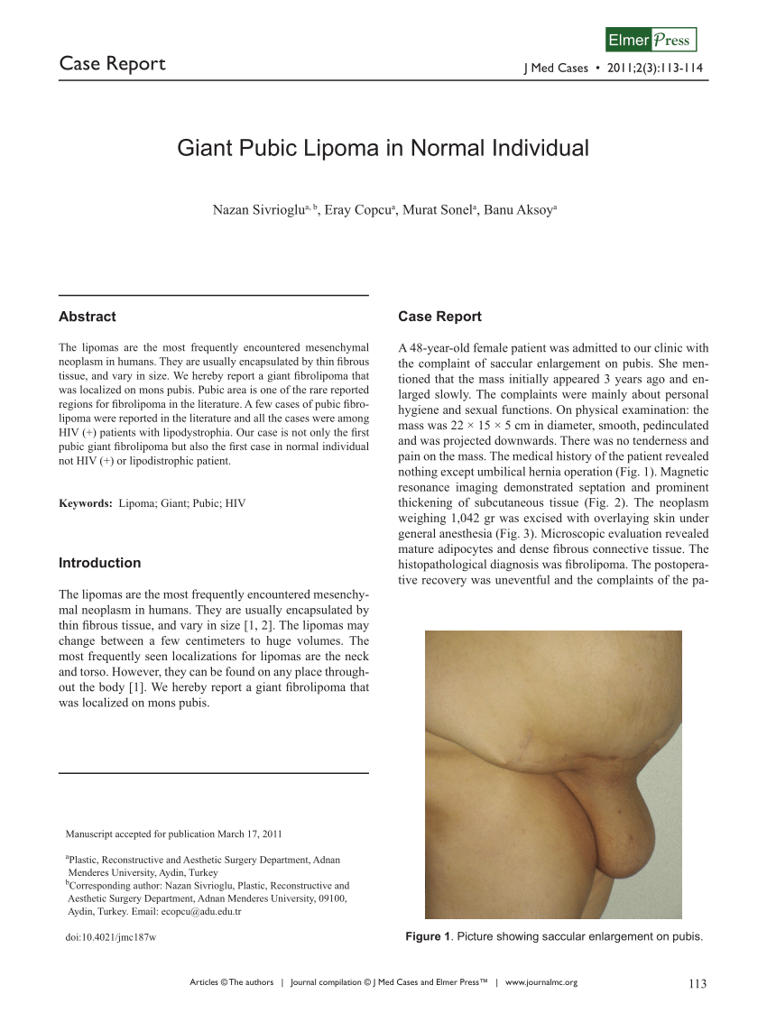 PDF) Giant Pubic Lipoma in Normal Individual