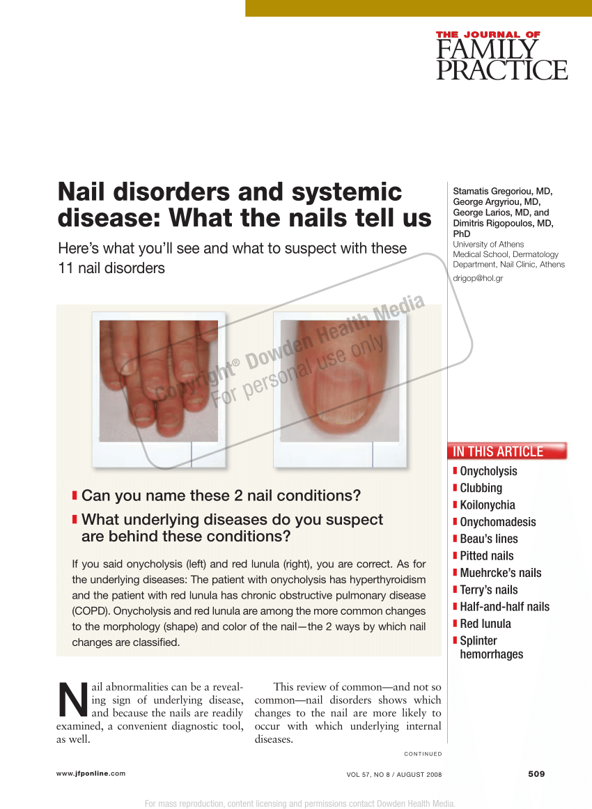 Nail Pathologies - Findings in or Near Nails Paronychia ... | GrepMed