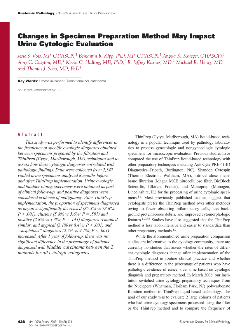 PDF) Changes in Specimen Preparation Method May Impact Urine ...