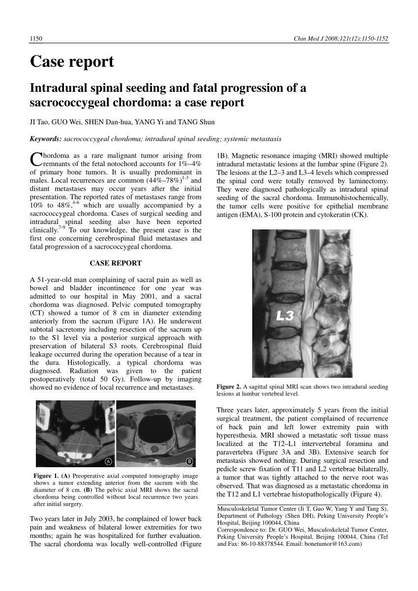 Pdf Intradural Spinal Seeding And Fatal Progression Of A Sacrococcygeal Chordoma A Case Report 3228