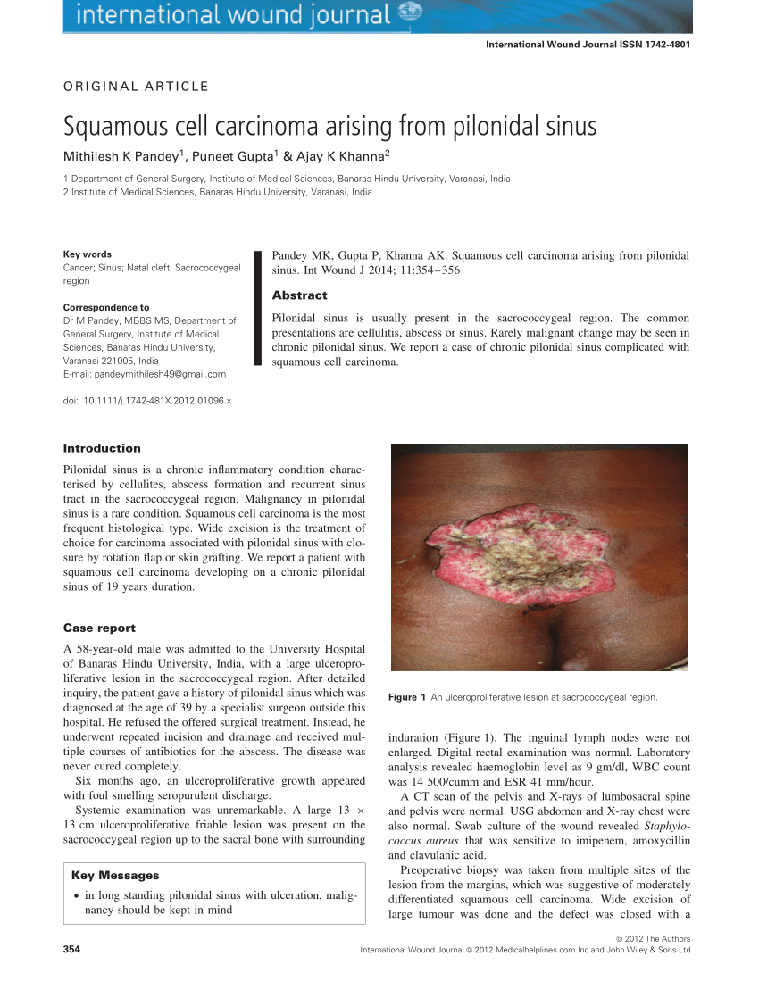 https://i1.rgstatic.net/publication/232228067_Squamous_cell_carcinoma_arising_from_pilonidal_sinus/links/6127141b3be6c17839c48ec7/largepreview.png